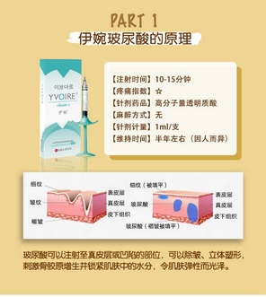 伊婉c玻尿酸适合打哪里？不同型号的区别及多少钱一支全攻略！