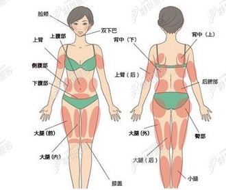 北京亚楠容悦医疗美容诊所吸脂瘦全身怎么样？蒋亚楠医生手术风格有什么特色！