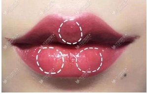 上唇M下唇花瓣好看吗？了解哪个更好看和适合你？给你介绍美学特点！