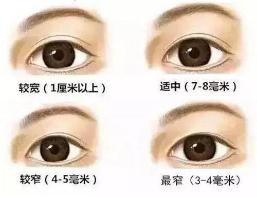 四川省人民医院刘全双眼皮怎么样?医生个人简介、技术风格点评!附价格