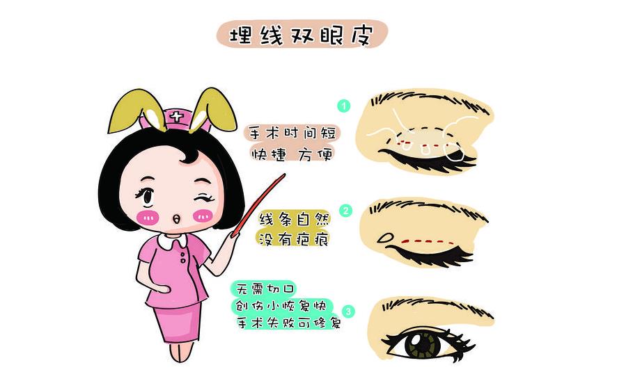双眼皮埋线和割的区别|哪个自然?价格、注意事项汇总!