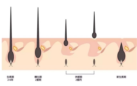 成都恒博头发种植怎么样？发际线种植好吗？附医院地址_医生简介！ 