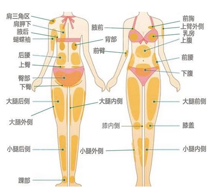 背部吸脂的亲身经历怎么样？哪些因素影响了吸脂手术？注意事项有哪些？
