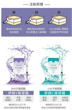 伊婉c和伊婉v的区别有哪些？各有哪些缺点_注意事项！面部轮廓塑形~
