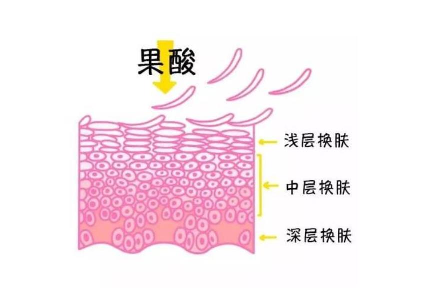男生怎样美白皮肤有效的方法:除了改良作息，光子、果酸也是不错的选择