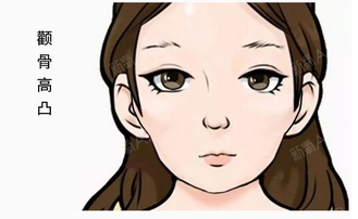 磨颧骨会下垂吗？术后应该怎样去护理呢？附手术原理~ 