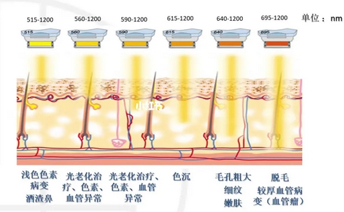 光子对痤疮的作用原理是什么？为什么会长痘痘！该怎么样调理？ 