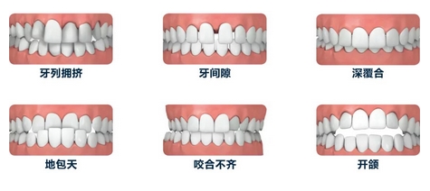 四医大口腔价格贵吗？医生_医院信息分享~牙齿矫正案例分享！