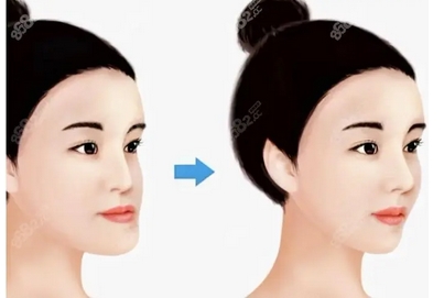 上海正颌手术好的医院有哪些?除了仁爱口碑不错之外,九院等4家也不赖