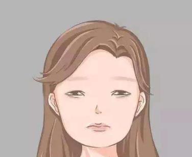额头窄丰额头要多少钱?用的什么材料比较好?注意事项有哪些