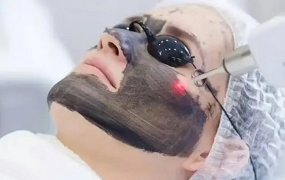 黑脸娃娃可以祛除色沉吗？黑脸娃娃手术有什么要注意的？改良色素沉着就选它！