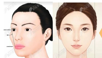 江苏颧骨内推专家谁好?崔磊、张东辉、吴国平等五位医生等你了解!