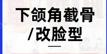南京做下颌角医生谁比较好?谁的综合实力稳居第一位!专家实力PK~
