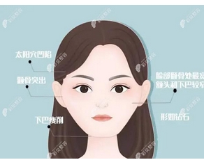福建颧骨内推公立医院排名公布!各家优势技术都不同,实力过硬!
