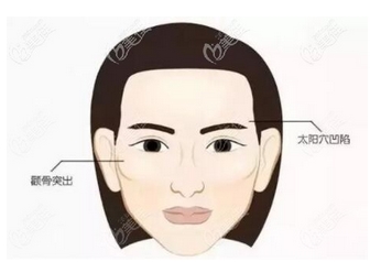 福建颧骨内推专家排名前十公布！医院实力如何？詹明坤/亓发芝等技术在线一览！