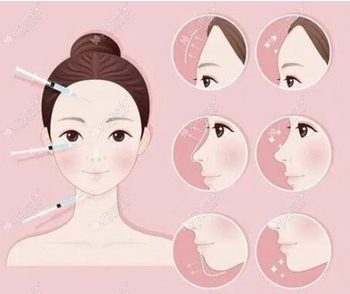 北京脂肪填充界的大咖有哪些？上线五位实力大咖技术审美均在线！带你参考~