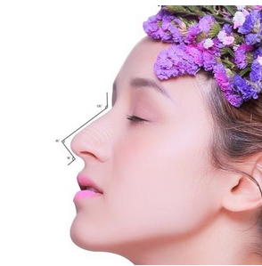 南昌做鼻子好的医生有哪些？1分钟读完的隆鼻攻略,姐妹们赶紧看！