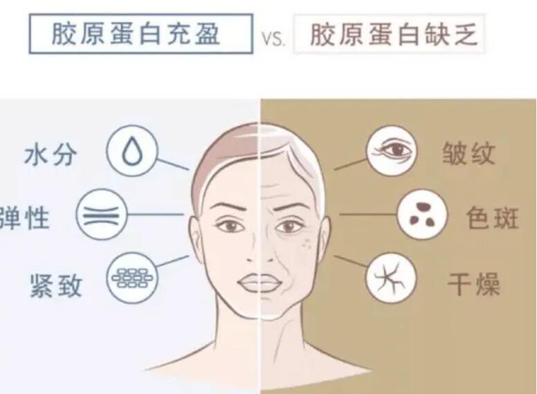 双美胶原蛋白填充多少钱一支？原理及价格表一览！