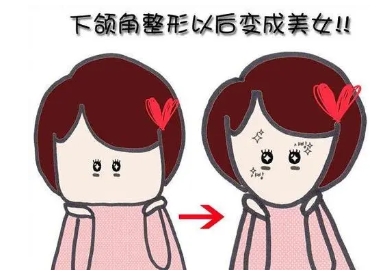 杭州做下颌角专家谁好?方下巴也想改良的话找谁?人气医生榜单出炉~
