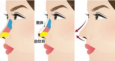 泉州做鼻子好的医生有哪些?擅长项目_从业年限都有介绍!资料信息一文汇聚!