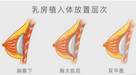 北京京美整形医院正规吗?医生信息|隆鼻去眼袋案例!实力口碑,评分高涨~