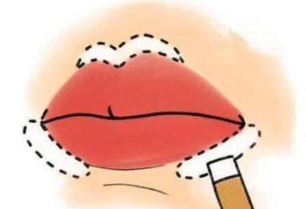 南京华美美容医院厚唇切薄多少钱？医院简介及真人对比图分享！