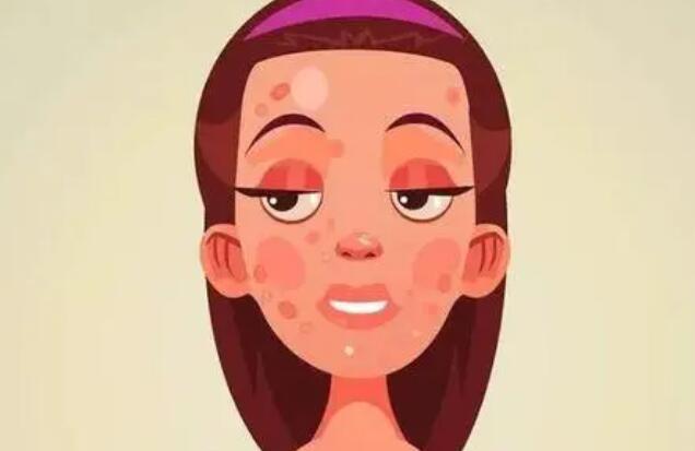 痘坑能去掉吗？效果怎么样？术后应该如何护理？