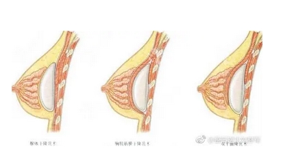 北京八大处刘春军怎么样？术后点评_医生资质带你了解！附口碑预览~