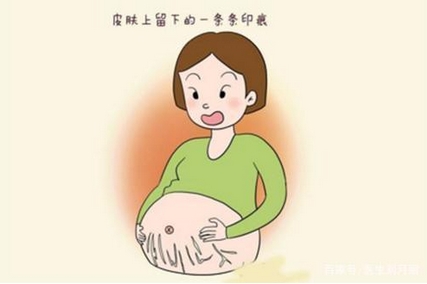 妊娠纹怎么才能去掉？修复期间有哪些注意事项？3个方法帮你淡化妊娠纹~