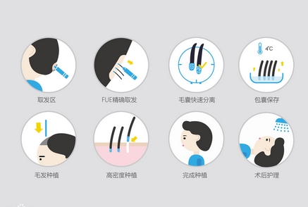 中信惠州医院植发技术怎么样？收费合理技术好深受当地人信赖！事关实力需知晓~