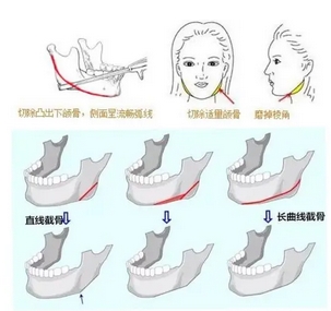八大处面部整形哪个医生好?三位实力不凡!牛峰、马继光人气热度盘点~
