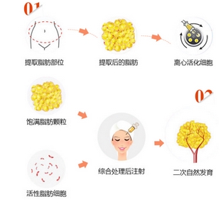 青岛华颜美整形医院怎么样?口碑解读、坐诊医生科普!附自体脂肪移植案例~