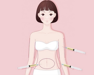 宋延刚吸脂评价如何？医生技术实力剖析，美体塑形案例曝光！