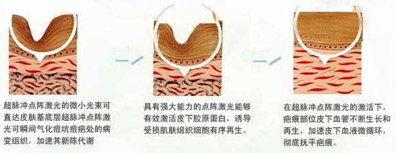 医学科学院美容科怎么样？本院医生张波简介_激光祛痘案例反馈