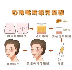 胡华新面部脂肪移植做的怎么样?技术口碑实力如何,先看这里!