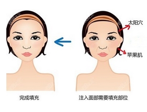 胡华新面部脂肪移植做的怎么样?技术口碑实力如何,先看这里!