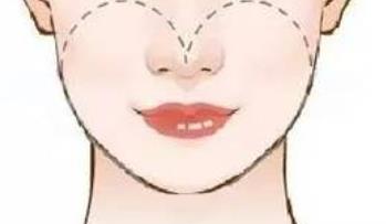 做完削骨手术之后多久能恢复？费用一般在多少呢？价格参考