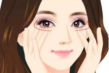 吴包金双眼皮价格如何?打造“妈生眼”!人气医生及双眼皮案例分享!