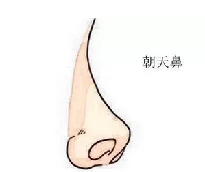 朝天鼻整形案例如何？实力案例全面盘点，“塌鼻星人”别错过！