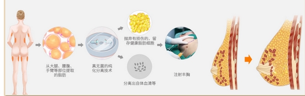 成都军建医院是公立医院吗？资料详情/拿手技术项目/优势点评！一应俱全~