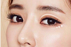 张冰洁眼综合案例怎么样?口碑医生实力如何|案例点评,供你参考!