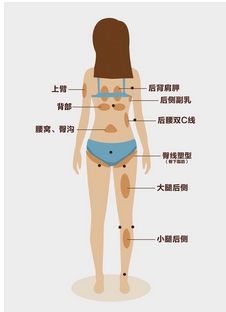 北京华悦府医疗美容医院怎么样?吸脂瘦腿案例真实介绍!熬过去就有漫画中的小腿!