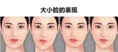 脸一边大一边小怎么纠正？调整这几个方面来改良！术后护理也很重要！