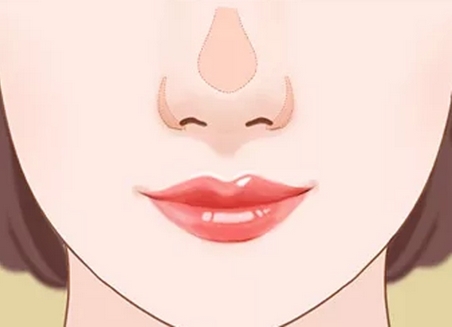 深圳李天石鼻子案例公开！鼻整形专家科普！美鼻人生不是梦想~