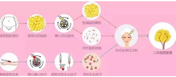 杭州连天美脂肪填充怎么样？这家口碑好性价比高！网友评价/医生简介揭秘很正规~ 