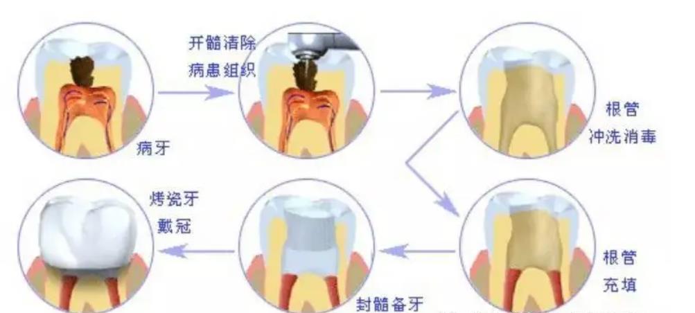 北京冠美口腔医院牙齿修复价格2023更新！附上医院简介、各分院位置