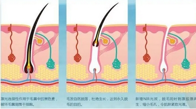 福建协和医院可以做激光脱毛吗?郭志辉、陈小松等医师谁的技术好些?附科室介绍~