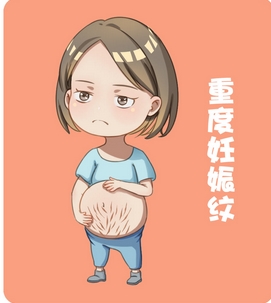 去妊娠纹大概多少钱？这4种方法，可以让妊娠纹恢复了很多！宝妈们的常见苦恼！