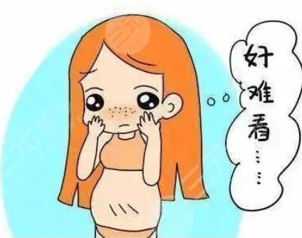 去妊娠纹大概多少钱？这4种方法，可以让妊娠纹恢复了很多！宝妈们的常见苦恼！