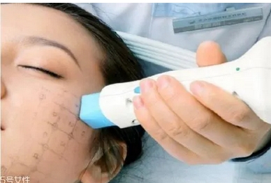 北京丽都可以做热玛吉吗？口碑医生介绍，抗衰日记-医生资料分享！